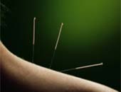 Akupunktra